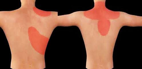 肩膀疼痛要警惕的三种病怎么治疗,肩膀疼痛要警惕的病怎么治疗