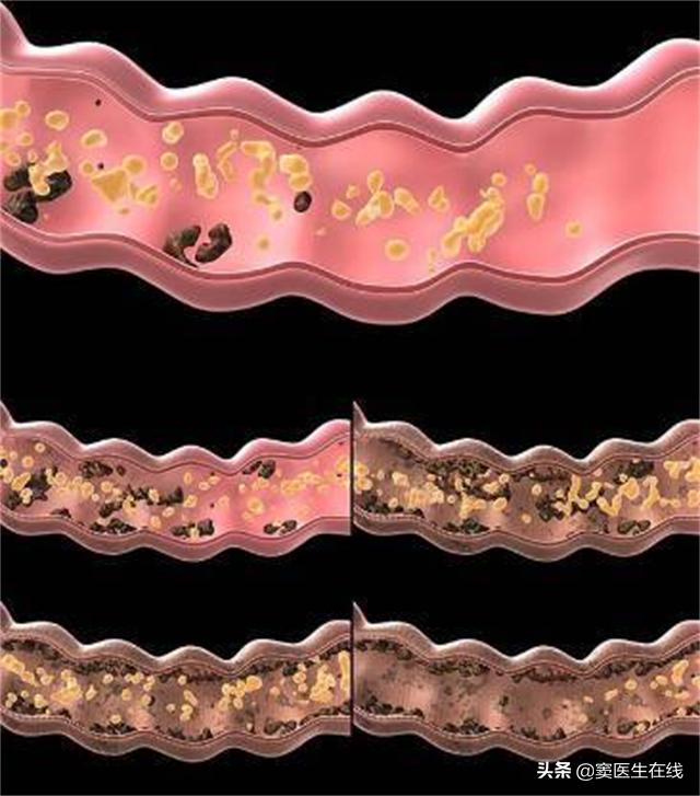 老人胃肠功能老化怎么治疗,高龄老人胃不好怎么调理