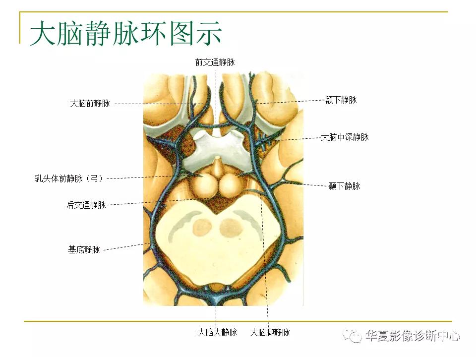 中国人脑立体定向mri应用解剖图谱,脑mri示意图