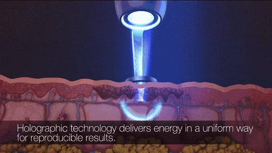 脸上的斑可以通过医美去掉吗,脸上长斑了能用激光去除吗