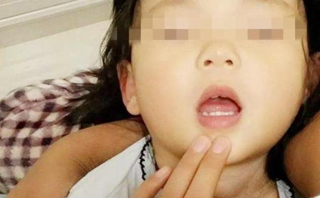 小孩吃鱼被刺卡到了快速解决,婴幼儿吃鱼被鱼刺卡到了怎么办