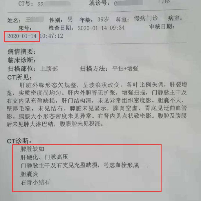 肝癌门静脉癌栓可以中药治疗吗,肝癌门静脉癌栓但是近期腹水消退