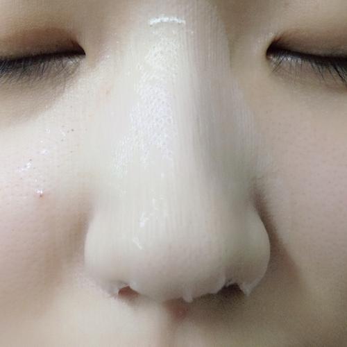 怎么清理黑头闭口毛孔最有效,不同肤质怎么护理黑头