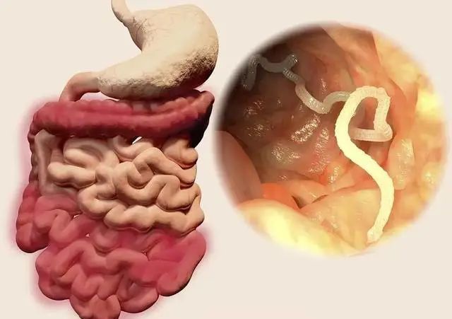 菊部边上长了个肉疙瘩,菊部周边有个白色脓包