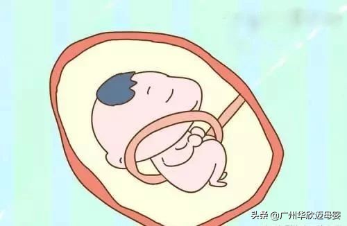 胎儿入盆是什么时候发动,胎儿入盆需要多久完成入盆