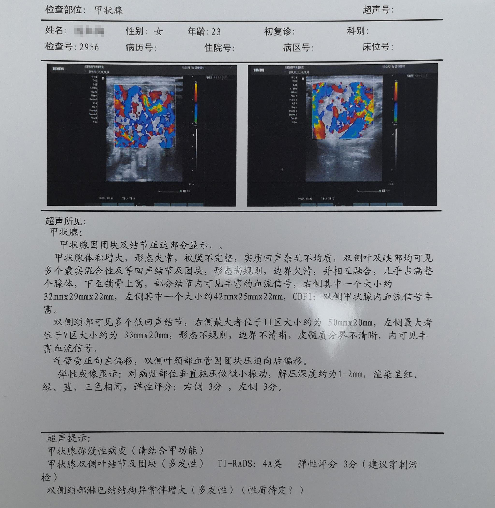 王玉芬教授：彩超报告，无回声、低回声、强回声是什么意思？