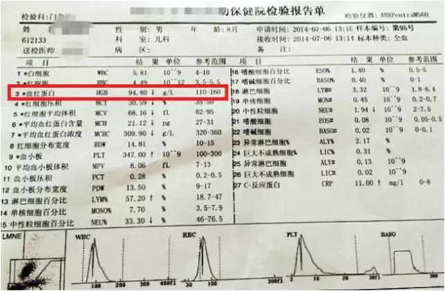 除了体检之外，家长还能怎么发现孩子贫血？