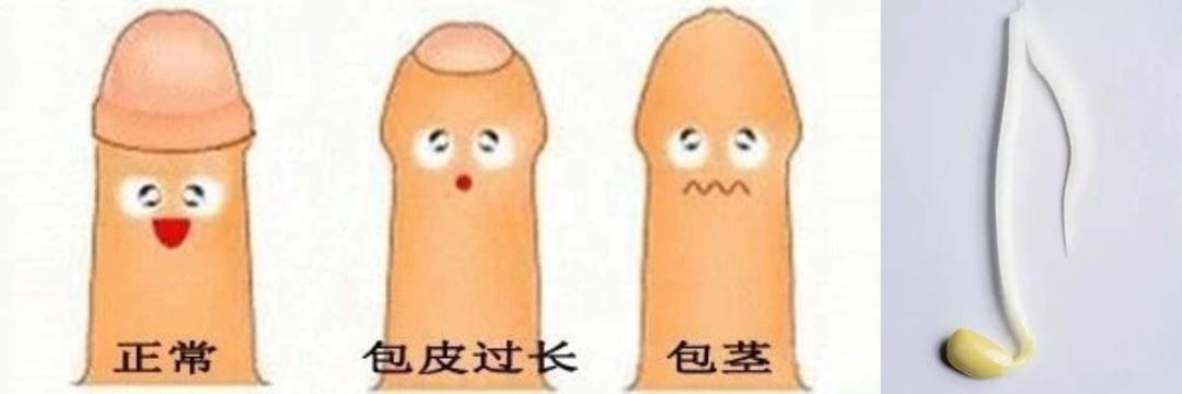 包皮过长除了做手术还有什么办法,包皮手术家长们看吗