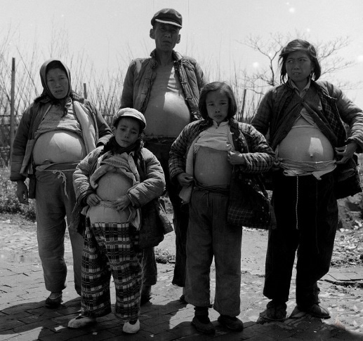 血吸虫会让肚子变大吗,血吸虫为何导致大肚子