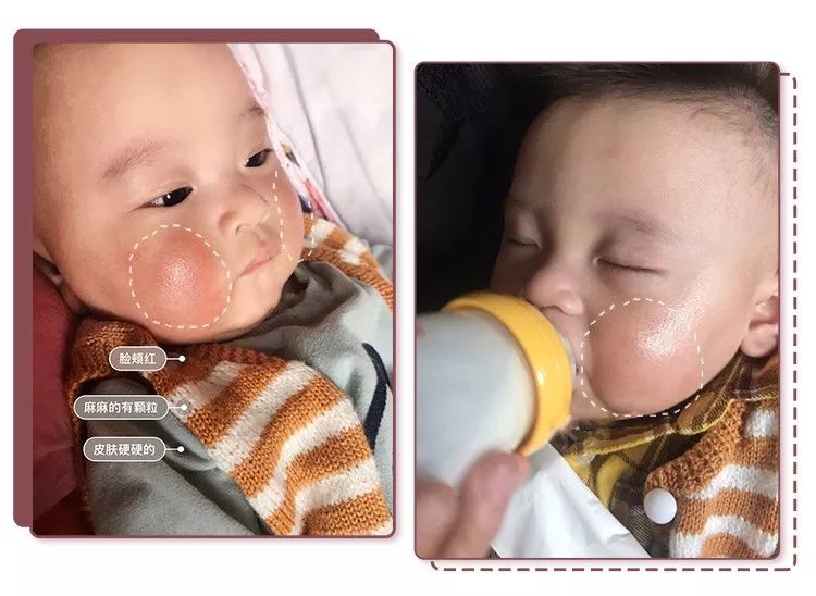 蔡依林护肤视频,蔡依林皮肤特护霜