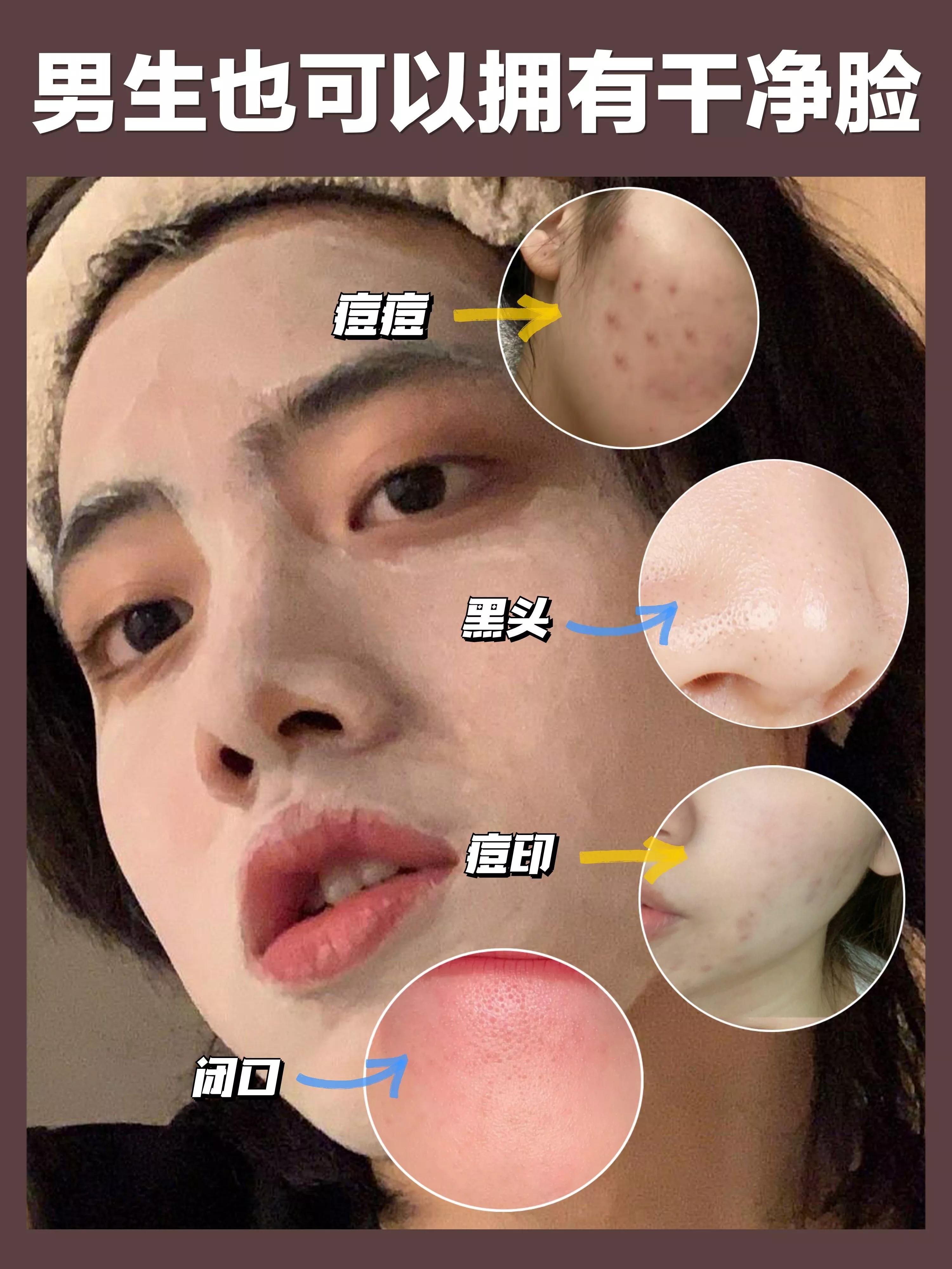 520送男朋友的美白护肤品,520礼物送老婆护肤品祛痘