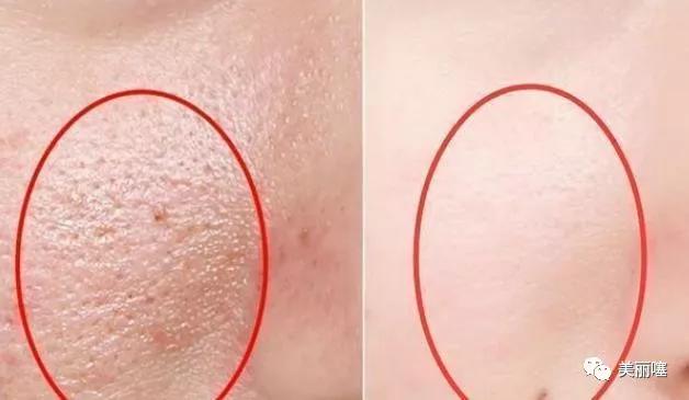 315曝光的五大国货恶心产品,315曝光化妆品代购