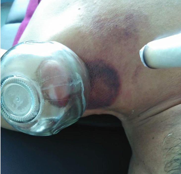 经脉不通是百病之源,经络通百病不生怎么办