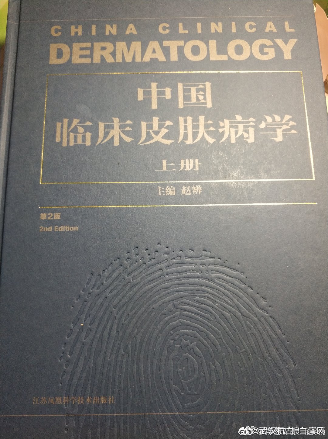有几种方法可以治白癜风,这才是白癜风的最佳治疗方法