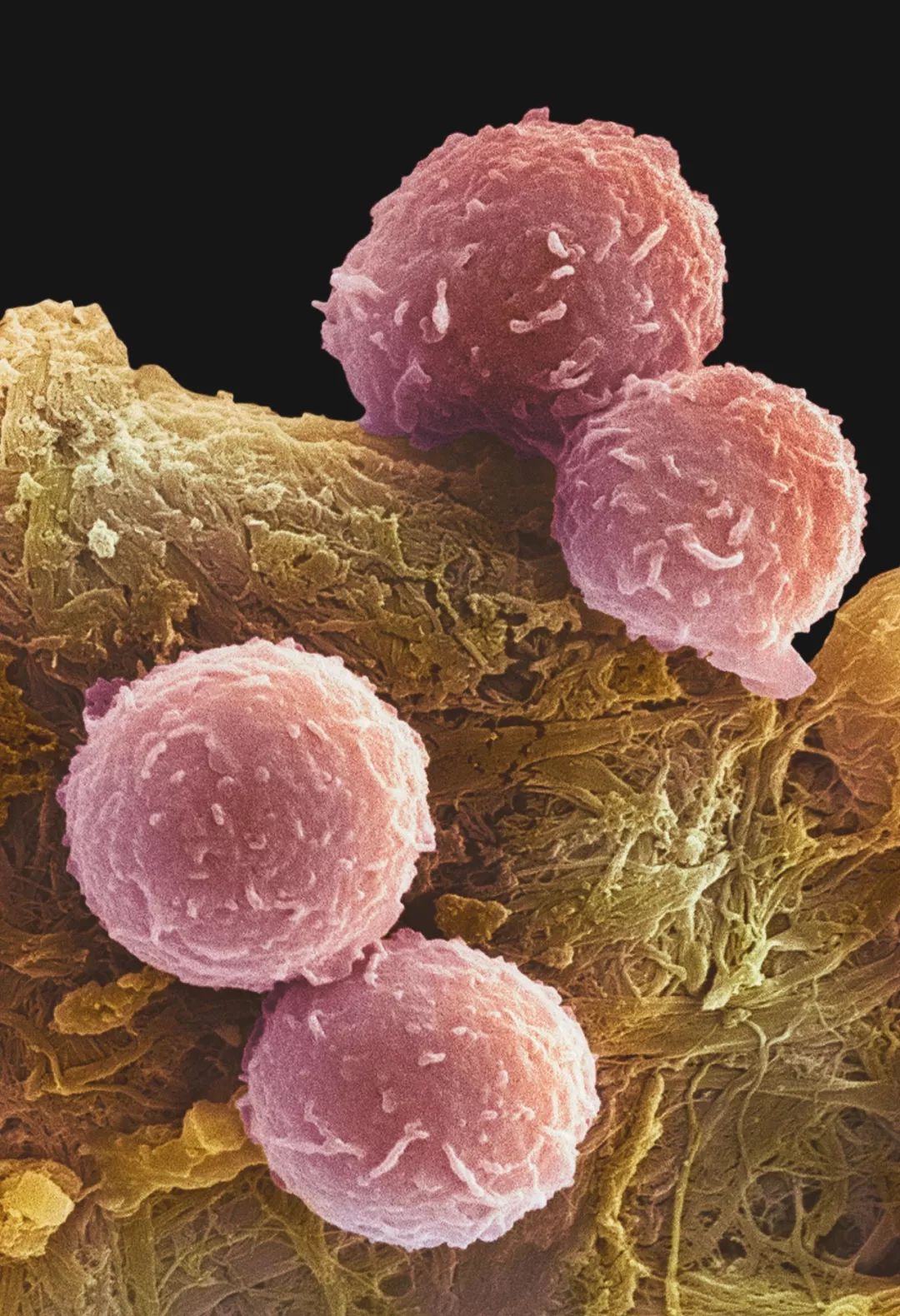 人体防卫战,人体痛点攻击技巧