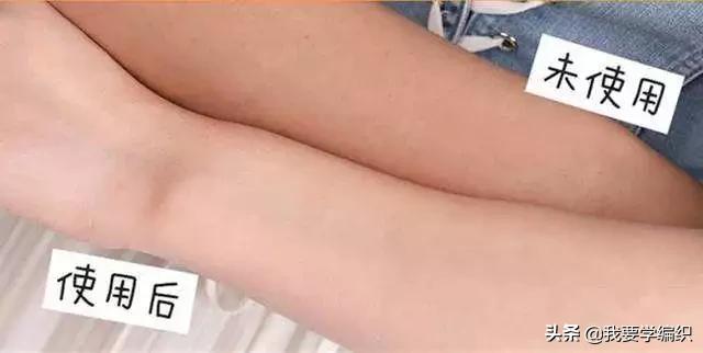 冬天干燥皮肤蛇皮,冬天冷皮肤粗糙