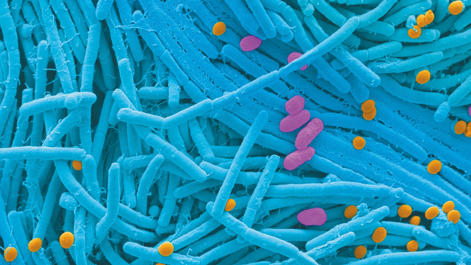 肠道菌群研究思路与案例解析,肠道菌群研究分析方法进展