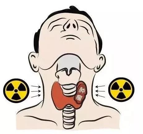 甲状腺结节频发，该拿它怎么办才好？