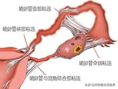 三胎备孕两年没怀孕检查都正常,三胎不孕用查免疫吗