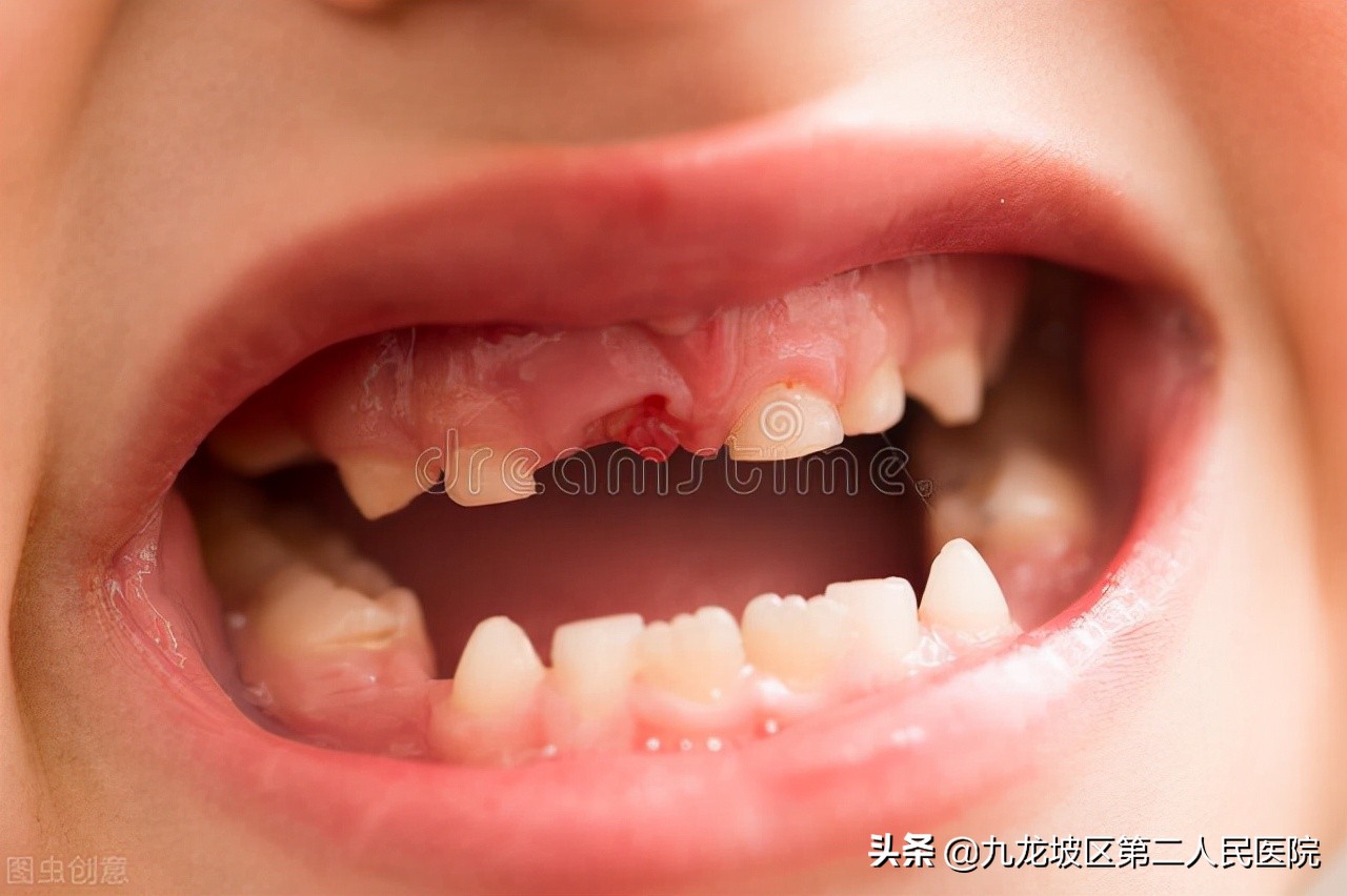 孩子牙不好被嘲笑怎么办,宝宝长牙齿老是会哭怎么办