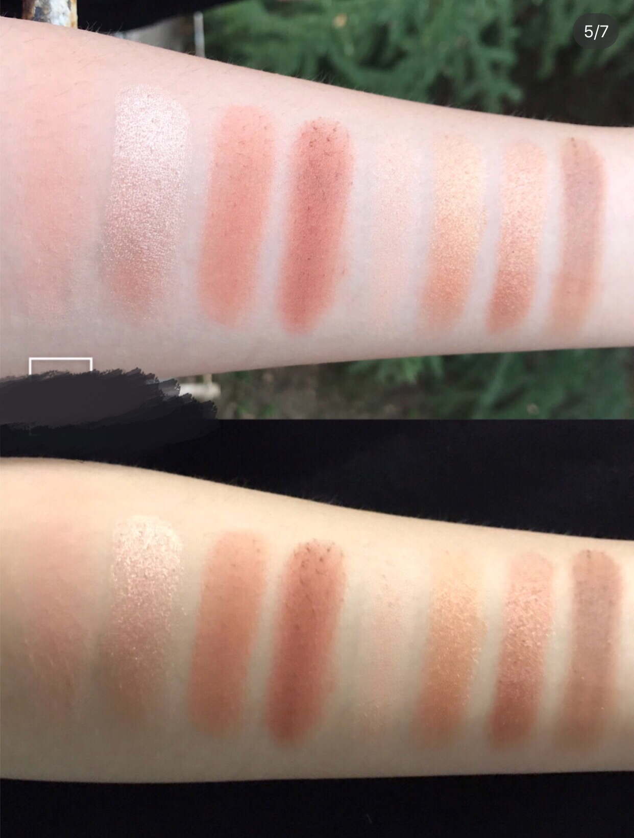 单眼皮浮肿变双眼皮怎么恢复正常,单眼皮眼皮无力怎么改善