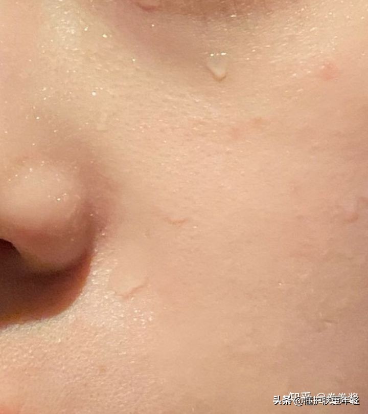 没有化妆可以用卸妆膏清洁皮肤吗,没有化妆可以用卸妆水清洁吗