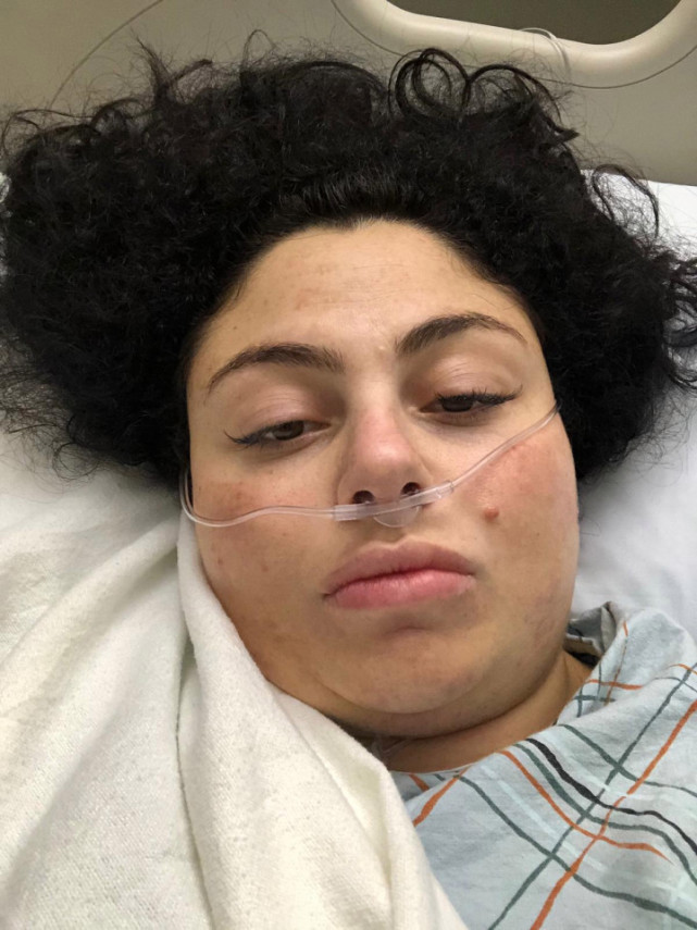 美国女子剖腹产后差点死亡，称伤口感染后身体发出一股恶臭