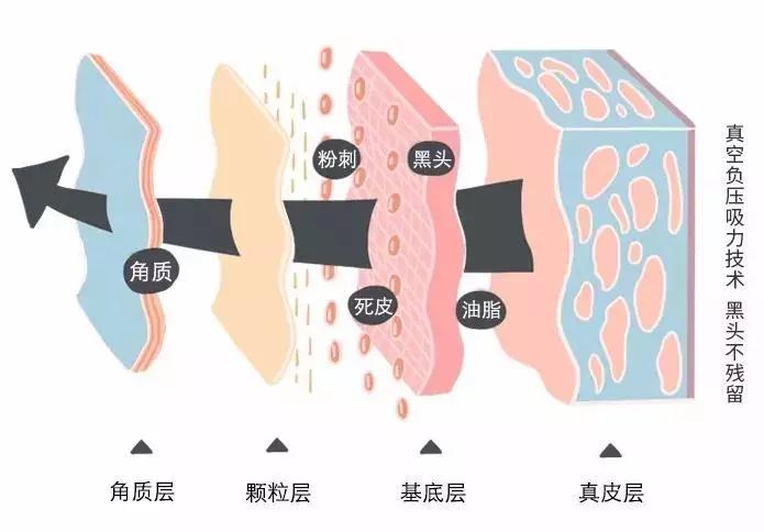 黑头闻起来很臭,黑头很痛怎么回事