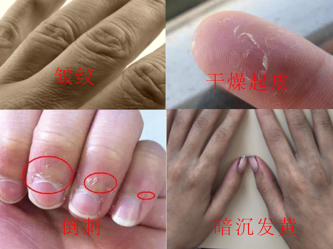 再年轻的脸也挡不住“奶奶”手，隐藏年龄的秘密，全靠这一只