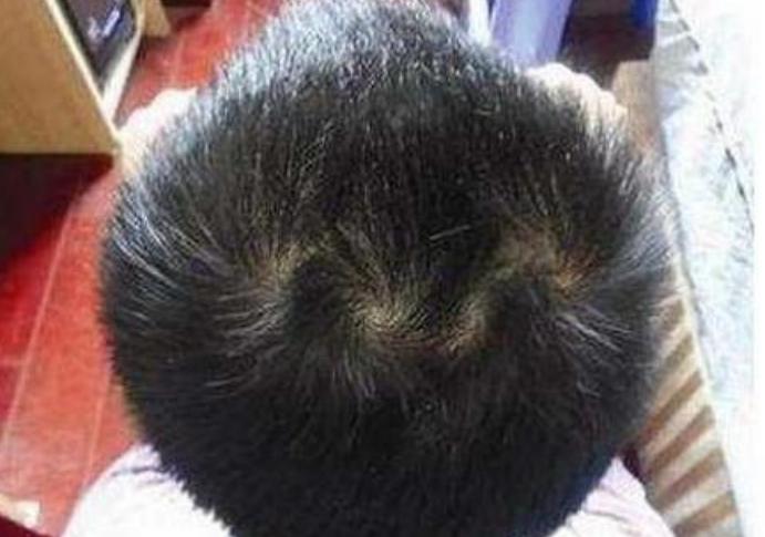 孩子头顶有两个旋性格,男孩头顶两个旋迷信说法
