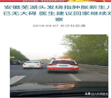 婴儿绕脖有什么危害,婴儿绕颈2圈有危险吗