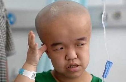 奶粉大头娃娃事件,大头娃娃奶粉事件