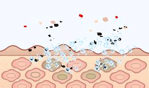 用这款植物香皂洗脸，3周除螨93.77%，痘痘明显改善，湿润不紧绷