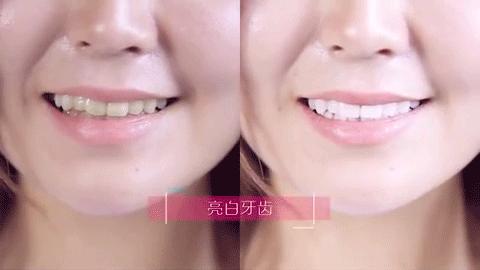 牙黄口臭三分钟见效,牙黄口臭去烟渍