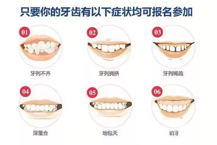 鍠滃ぇ鏅鏈夊暐浼樻儬,鍠滃ぇ鏅浼樻儬