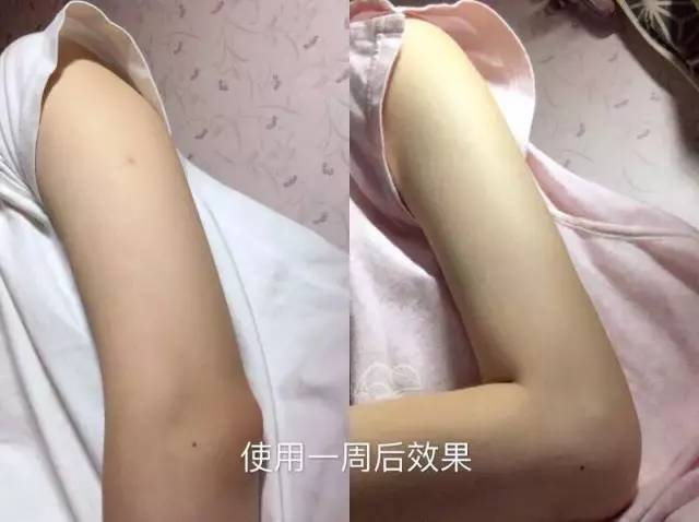 你到底是水肿还是胖？先了解之后再节食好么？！