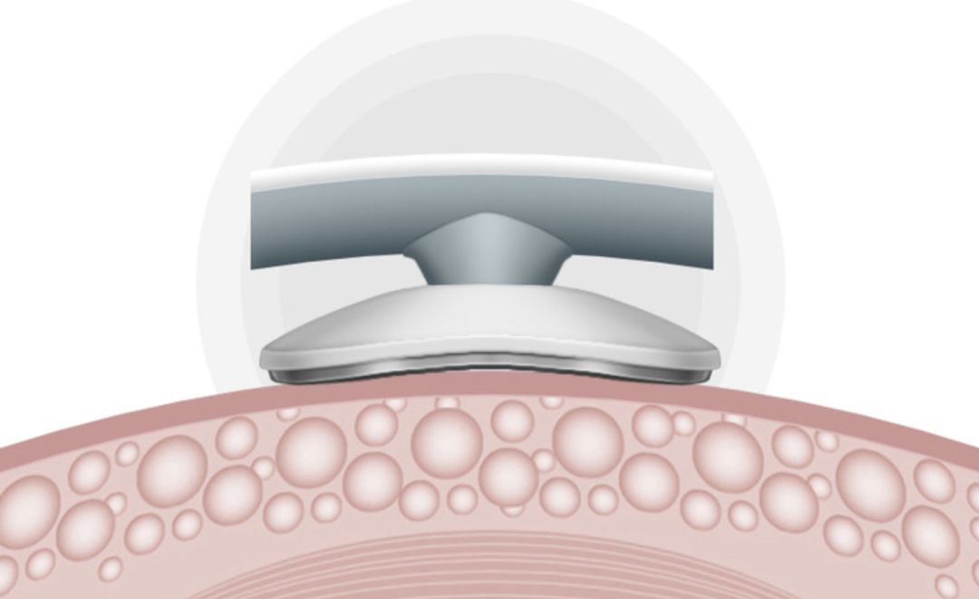 颈椎按摩神器明星推荐,颈椎按摩神器电动仪推荐