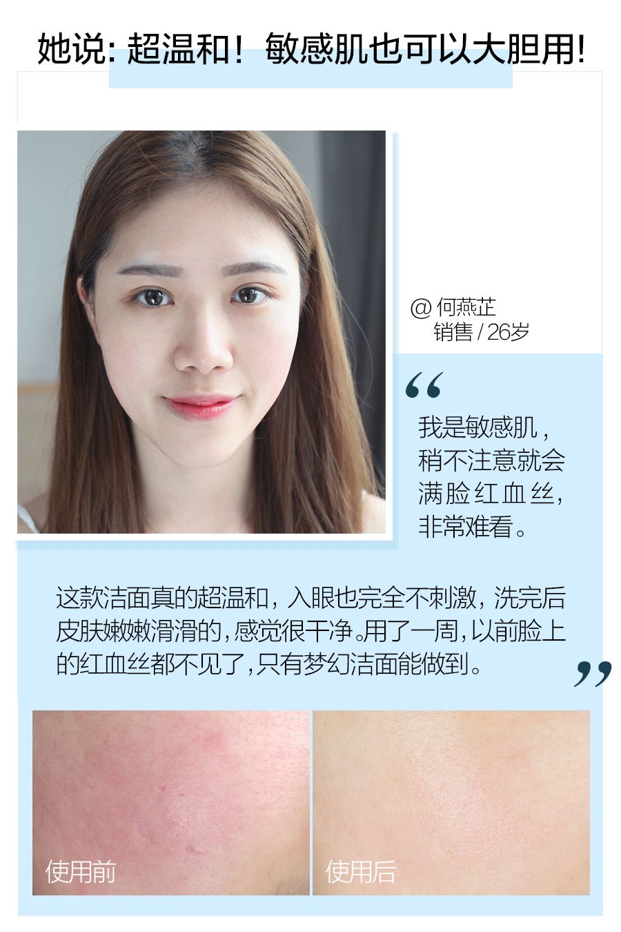 这样洗脸让你一步步毁容,这样洗脸让你皮肤越来越差