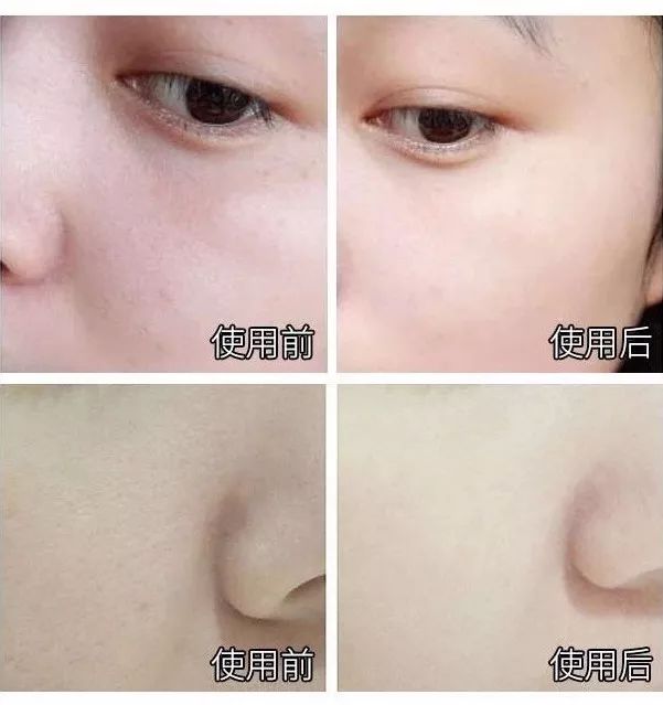 教你搞定肤色暗沉问题,肤色暗沉无光泽怎么改善