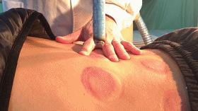 「传统医药日」秋冬预防季节性疾病，巧用艾条“自灸”益处多