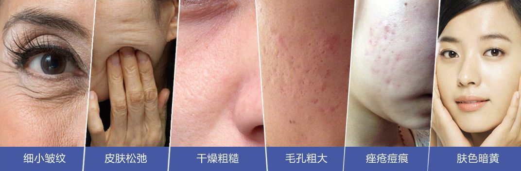 美白针可以10天打一次吗,可以美白的针