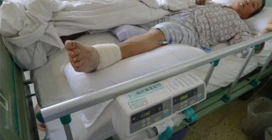 腹膜后肿瘤导致下肢水肿怎么办,肿瘤引起下肢水肿怎么治疗