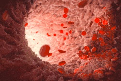 吃盐少摄入盐分不足的危害有哪些,低盐饮食是摄入盐越少越健康吗