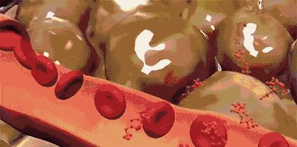 腿细翘臀神器,腿变得又细又直神器