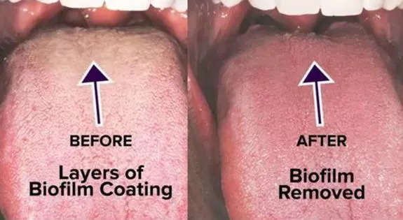 专治牙黄口臭超好用牙膏明星同款,牙膏测评美白去黄清新口气第一名