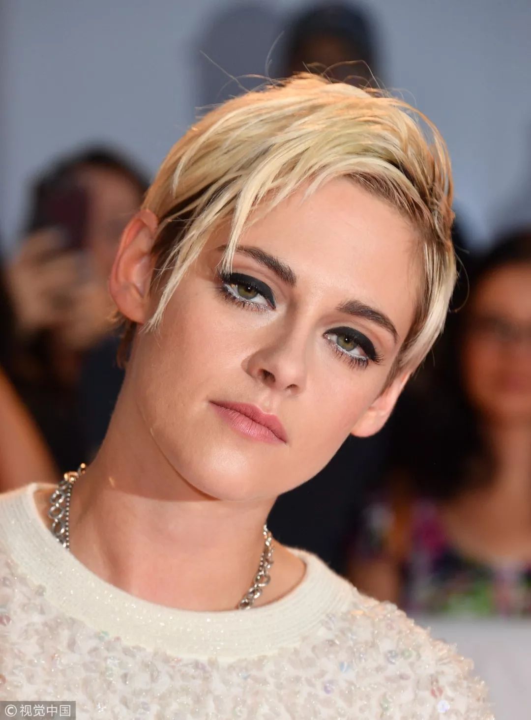 脖子为什么会有一道杠,脖子上出现几道杠会得什么病