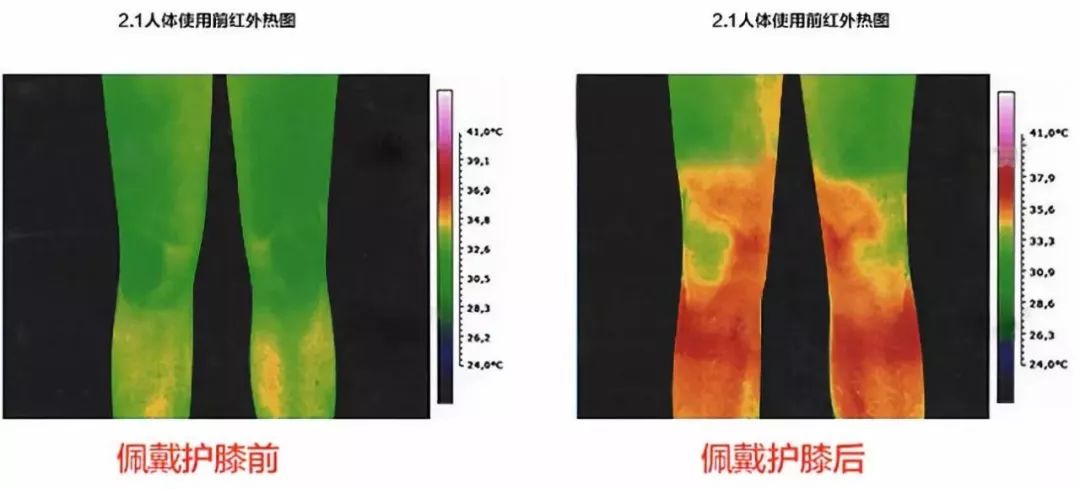 护膝电热保暖老寒腿,老寒腿护膝黑科技产品