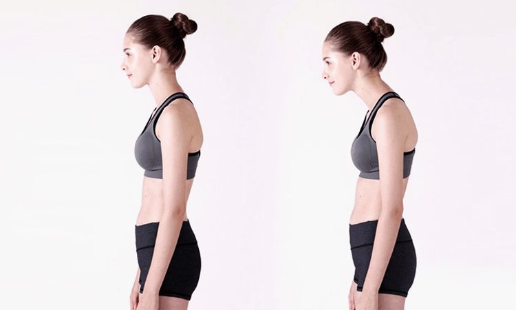 告别含胸驼背操,告别驼背练习