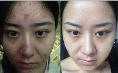 纳尼？！种草榜首的日妆精华只要5折（内附链接+赠品领取攻略）