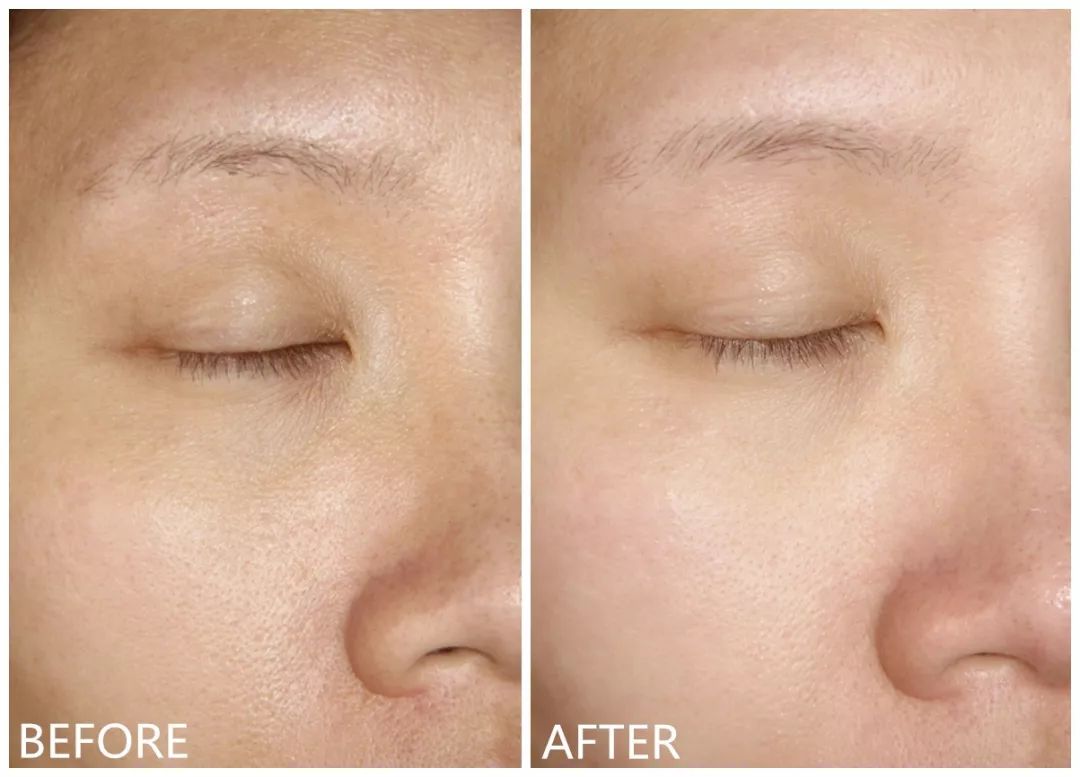 明星同款兰蔻必买清单,兰蔻最爆款单品